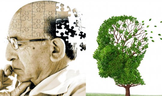 Photo of ალცჰაიმერის დაავადება – უახლესი მიდგომა (ვიდეო)