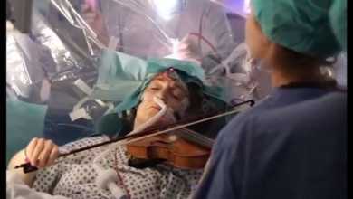 Photo of მუსიკოსი თავის ტვინზე ოპერაციის მიმდინარეობისას ვიოლინოზე უკრავს (ვიდეო)