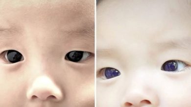Photo of ჩვილს ყავისფერი თვალები გაულურჯდა მას შემდეგ, რაც კოვიდის სამკურნალო პრეპარატი მისცეს